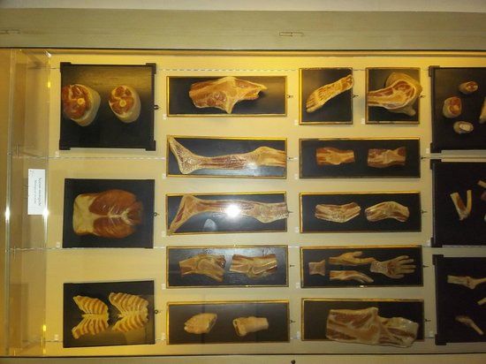 Museo delle Cere Anatomiche "Luigi Cattaneo"